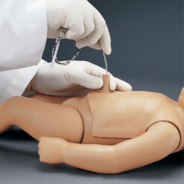 Erler-Zimmer Nabelschnurpunktion für R17700