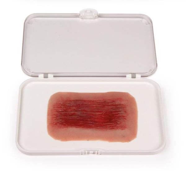 Erler-Zimmer Wundmoulage Schürfwunde