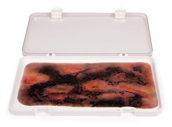 Erler-Zimmer Wundmoulage Verbrennung III. Grades