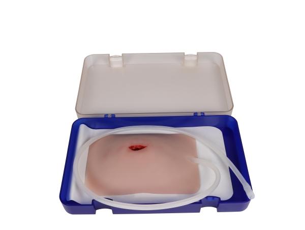 Erler-Zimmer Wundmoulage Stich Leiste, Wound Packing