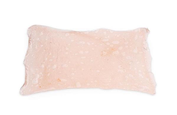 Erler-Zimmer Simulierte Verbrennungen 1. Grades