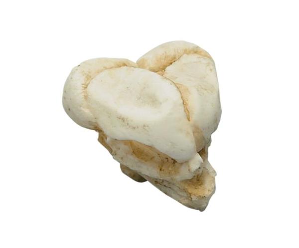 Erler-Zimmer Fetusschädel, 13 Wochen