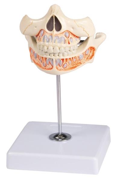 Erler-Zimmer Milchgebiß, 5jährig