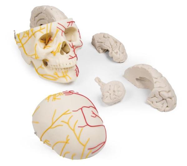 Erler-Zimmer Neurovasculärer Schädel mit Gehirn