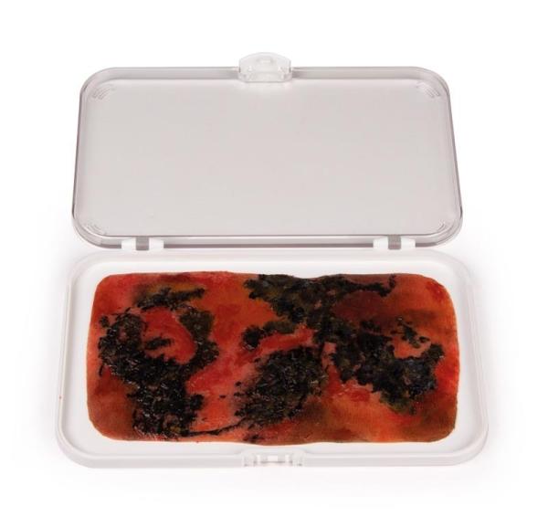 Erler-Zimmer Wundmoulage Brandwunde 3. Grades