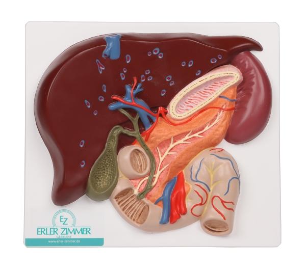 Erler-Zimmer Leber mit Gallenblase, Pankreas und Duodenum