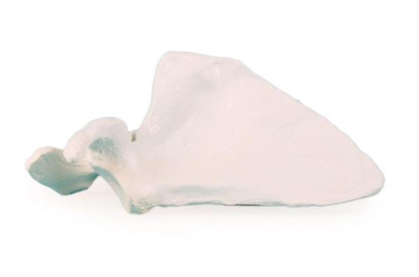 Erler-Zimmer Scapula (Schulterblatt)