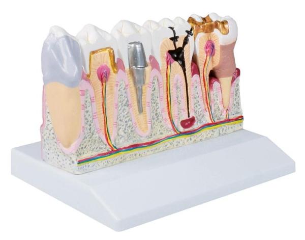 Erler-Zimmer Dentalmodell, 4-fache Größe - EZ Augmented Anatomy