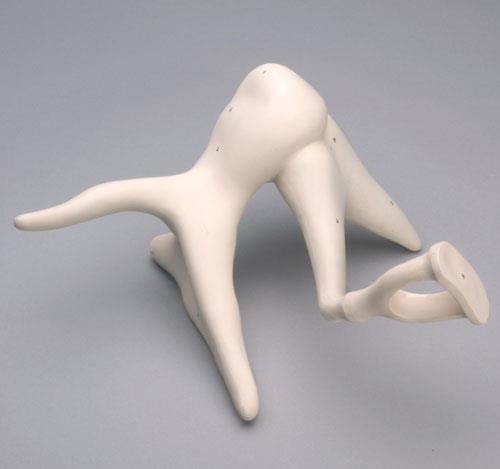 Erler-Zimmer Gehörknöchelchen-Kette