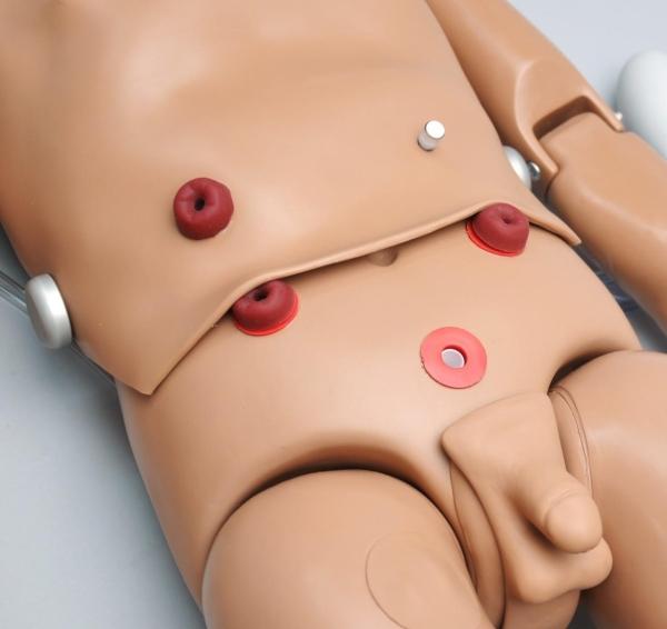 Erler-Zimmer Externe Stomata mit internen Reservoirs für R17720