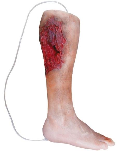 Erler-Zimmer Notfall-Unterschenkel Erler-Zimmer Notfall-Unterschenkel