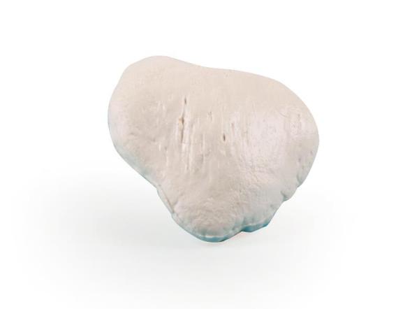 Erler-Zimmer Patella (Kniescheibe)