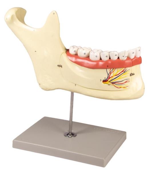 Erler-Zimmer Unterkiefer, 6 Teile