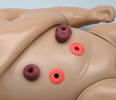 Erler-Zimmer Stomata mit Reservoirs für R17700