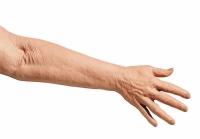 Erler-Zimmer Übungsarm Intravenöse Injektion