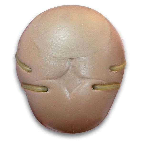 Erler-Zimmer Schädelvenenpunktion für R17700